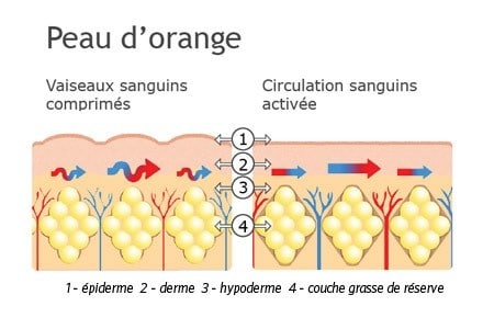 de graisse sous cutanée est elle réellement le seule apanage de 