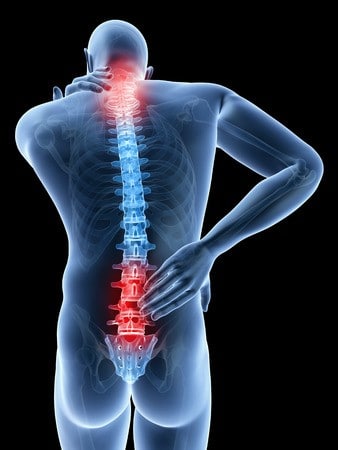 un dessin illustrant des douleurs chroniques du dos